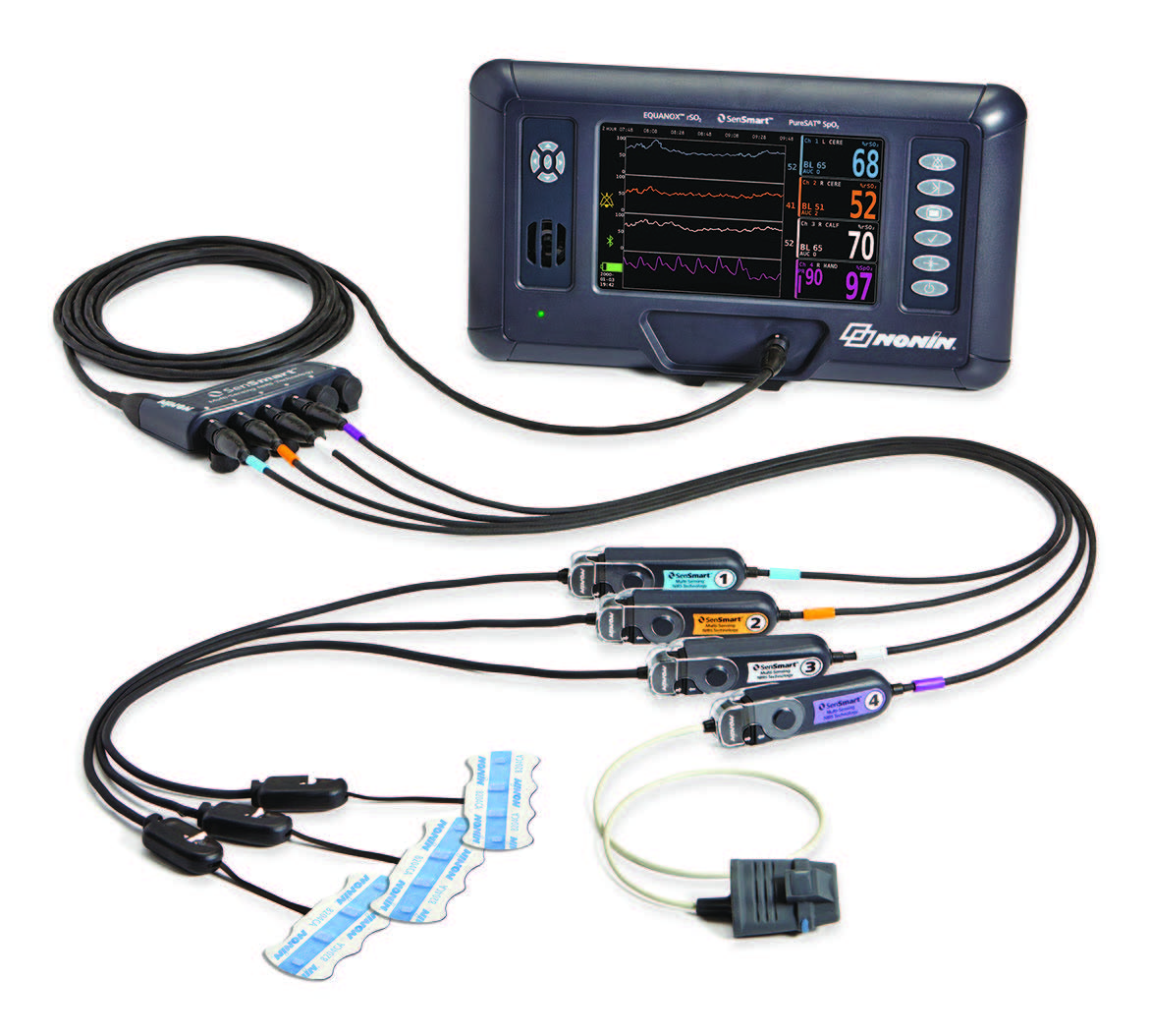 SenSmart® Model X-100 oximetriás rendszer