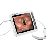 HugeMed videólaringoszkóp