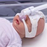 First Breath™ nCPAP rendszer